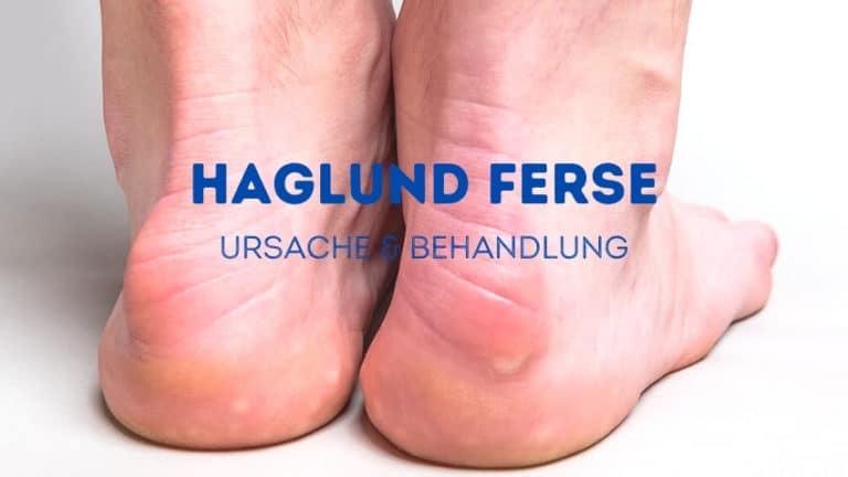 Haglund Ferse ️ Behandlung: Übungen oder OP?